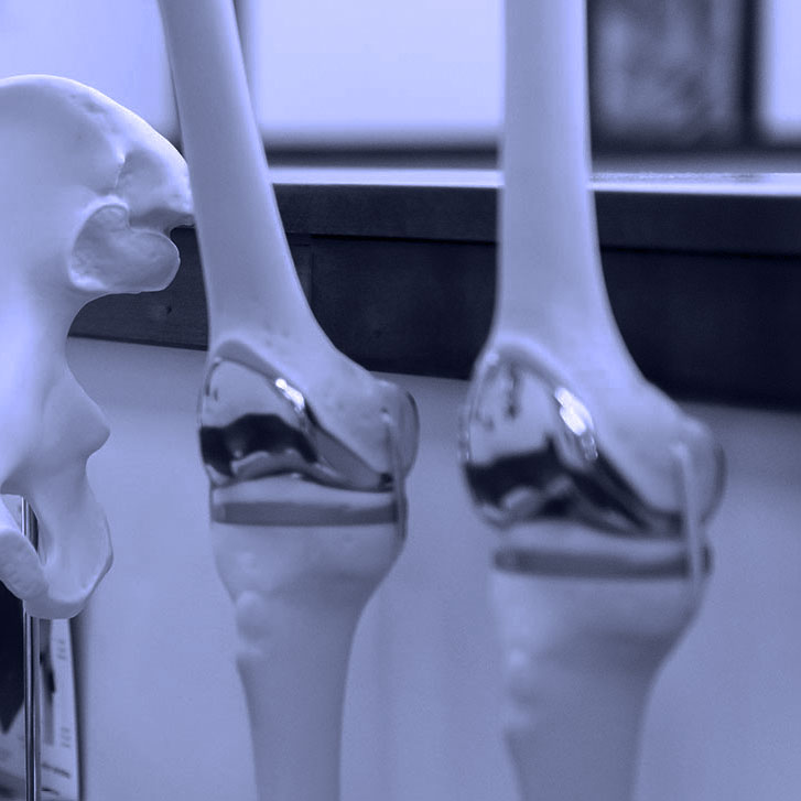 knee joint models